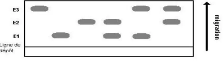 Fig. 4 – Gel de prot´ eine