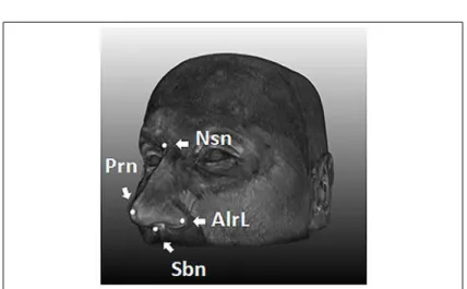 Figure 4 – Copie d’écran de la figure 1B de [3]. Les points caractéristiques du nez. Les ailes droites AlareR et gauches du nez AlareL