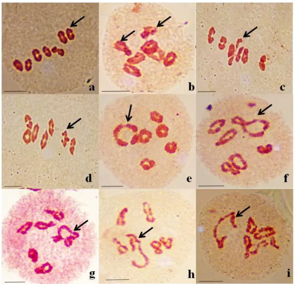 Fig. 4. Aspects des différents types d’appariements en métaphase I chez H. bulbosum L 