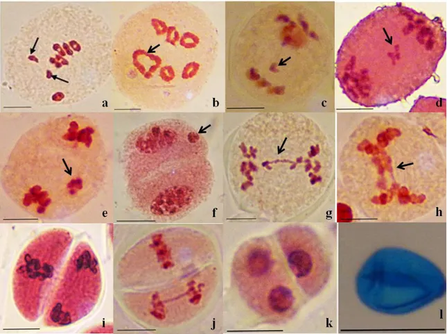 Fig. 7. Aspect des différentes anomalies méiotiques dans les cellules mères de pollen en  division chez H