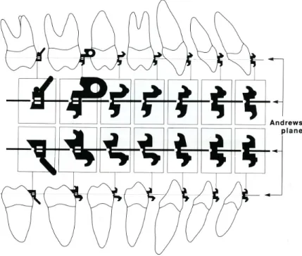 Fig.  2:  Dans  les  boîtiers  programmés  utilisés  avec  la  méthode  à  fil  droit,  une  valeur  de  torque  est  incorporée  dans  le  boîtier  pour  chacune  des  dents  afin  d’obtenir  une  bonne inclinaison bucco-linguale  des racines tout en ayan