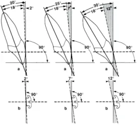 Fig. 4 : En moyenne, il existe un angle de 18 o  entre la surface buccale d’une centrale supérieure et 