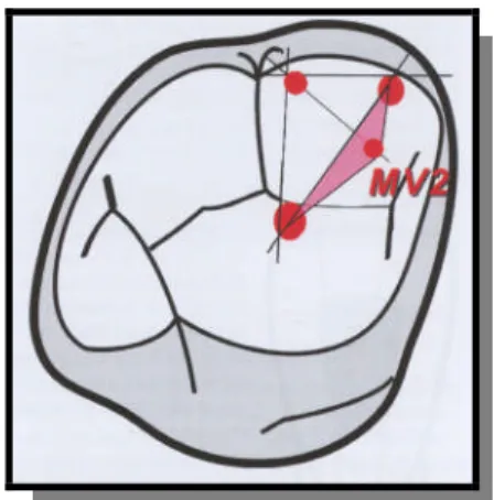 Fig. 22: Localisation du 4ème canal (MV2). [50]
