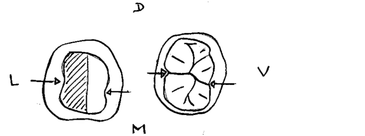Figure 7 : Comparaison de la petite dent avec une 36 intacte. Vue occlusale