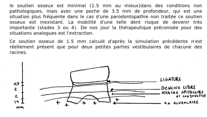 Figure 10a : simulation de la position de la dent dans une situation parodontale idéale en vue vestibulaire