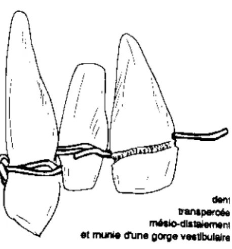 figure 2 : d’après Bardinet  (5)  Vue vestibulaire