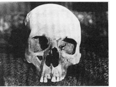 Figure 1 : Le crâne d’Hélouan D’après J. J.Quenouille  (38)