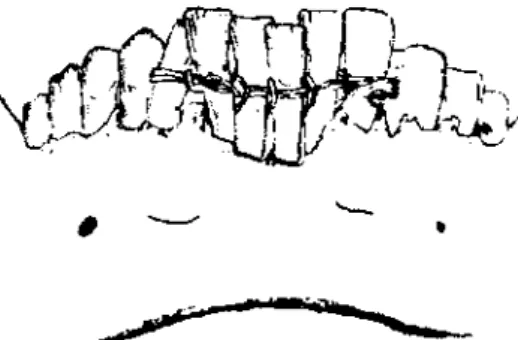 Figure 1 : d’après Don Clawson Vue de face