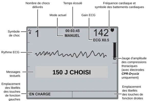 Figure 1-3. Eléments de l’écran de l’AED Pro