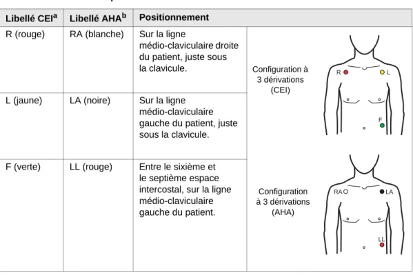 Tableau 5-1. Libellé et positionnement des électrodes ECG