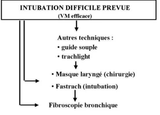 Fig. 4. Proposition d’algorithme simplifié devant une intubation difficile avec une ventilation au masque (VM) efficace
