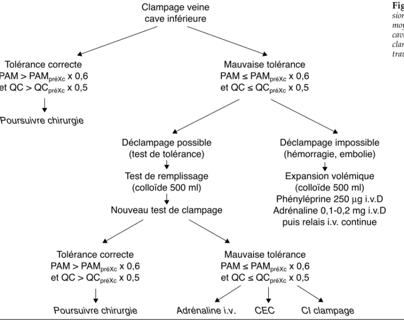 Figure 3 Prise en charge hémodynamique de l’exclu- l’exclu-sion vasculaire du foie mal tolérée