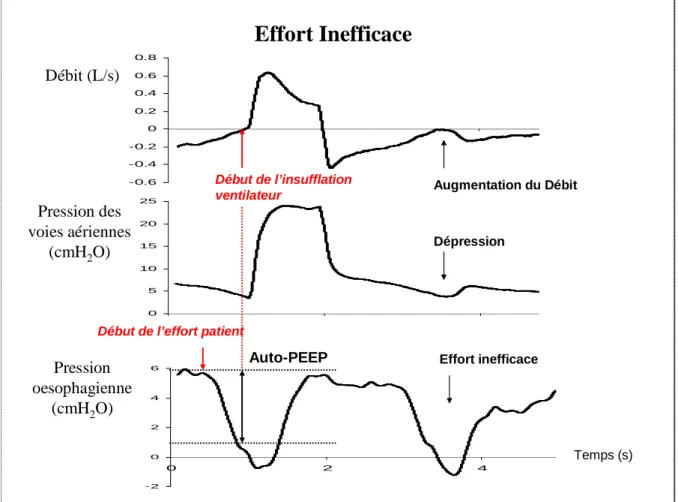 Figure 3: Effort inefficace et PEP intrinsèque 