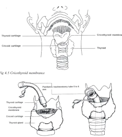Fig 4.5 Cricothyroid membrance