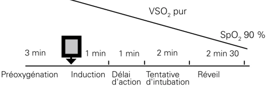 Figure 1  : durée d’apnée après une pré-oxygénation et séquence d’induction  rapide