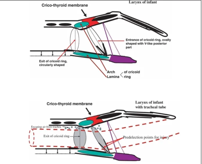 Figure 1 (7): Le cartilage cricoïde est une structure complexe avec une entrée en forme d’ovale