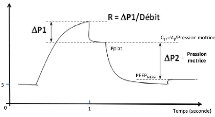 Figure  3 :  Courbe  pression  temps  des  voies  aériennes 