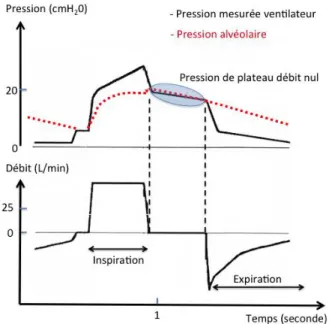Figure 1.  Pression mesurée par le ventilateur et  pression alvéolaire 