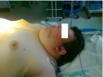 Figure  1  Airway  evaluation  of  the  patient  revealed  increased  neck  circumflex 