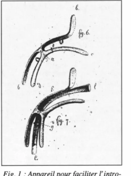 Fig. 1 : Appareil pour faciliter l'intro- l'intro-duction de la canule dans la trachée  de J