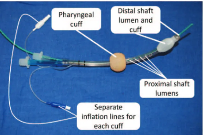 Figure 13. Nellcor Puritan Bennett Esophageal Tracheal Combi- Combi-tube™. Green exchange catheter in distal lumen is for demonstration purposes.