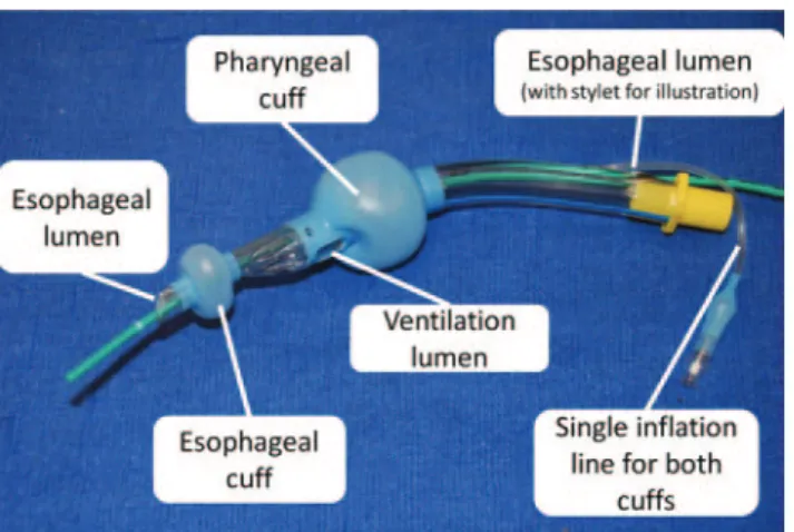 Figure 15. Intersurgical i-gel™. Green exchange catheter in drainage lumen is for demonstration purposes.