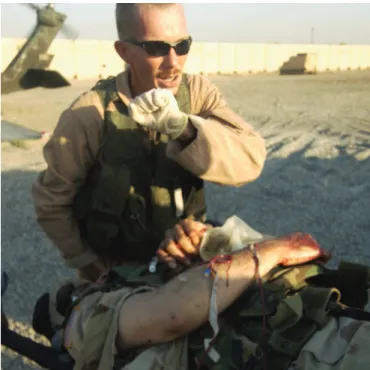Figure 13. A US casualty with a neck injury is loaded onto a UH-60 