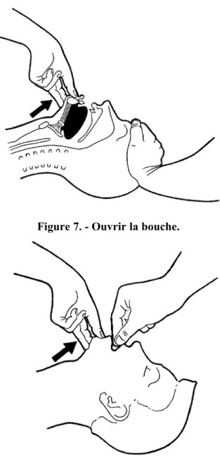 Figure 7. - Ouvrir la bouche.