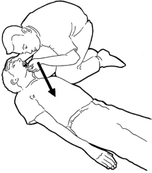 Figure 9. - S’assurer de l’absence de respiration.