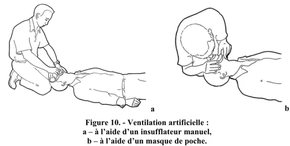 Figure 10. - Ventilation artificielle : a – à l’aide d’un insufflateur manuel,