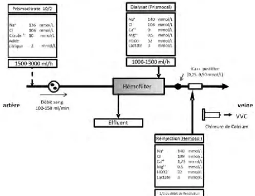 Figure 4 :  exemple d’utilisation en CVVHDF d’une solution de citrate trisodique  à 0,4 % en prédilution avec une Prismaflex (Gambro).