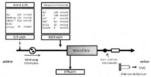 Figure 5 :  exemple d’utilisation en CVVH d’une solution de citrate ACD-A 3,3 %.  D’après Munjal et Ejaz [21].