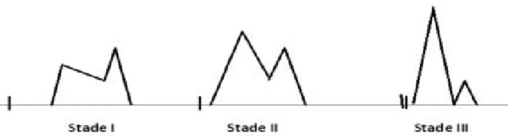 Figure 2 :  Représentation schématique des altérations du flux mitral en Doppler  pulsé