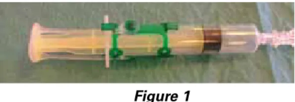 Figure 1  3.2. l’éCho-REPéRagE PRé-PRoCéduRal