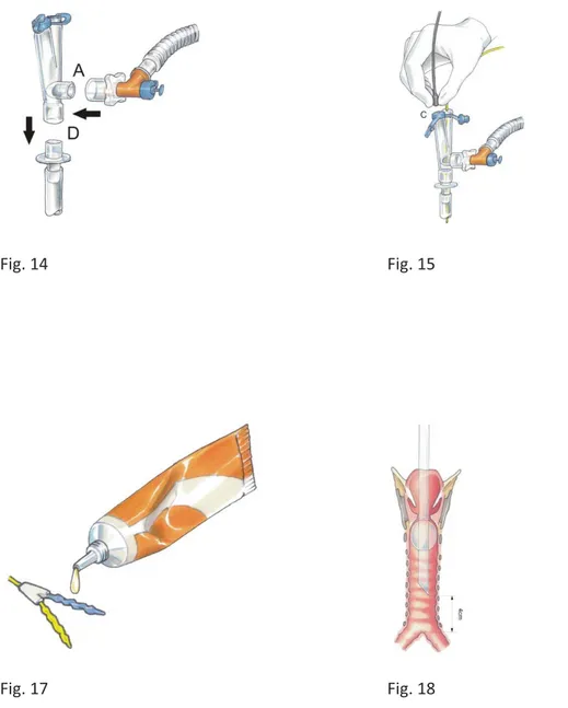 Fig. 13  Fig. 14  Fig. 15 