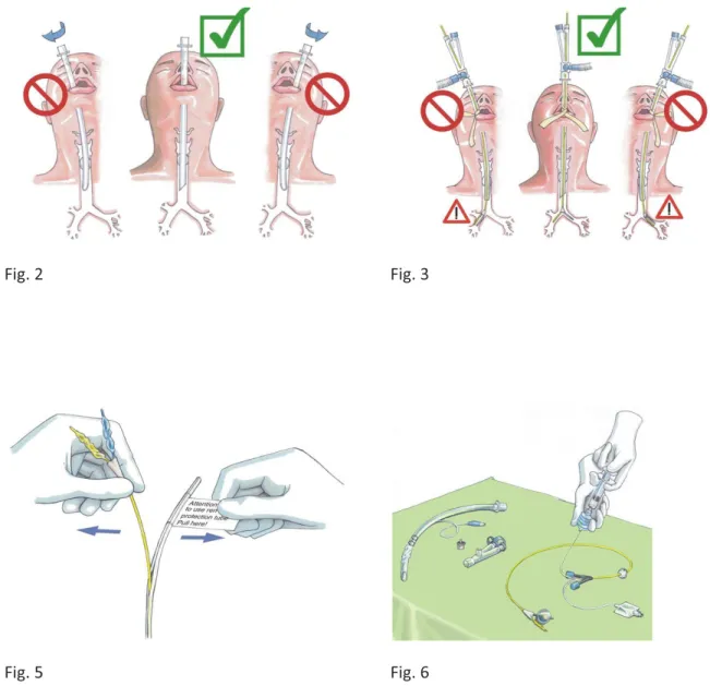 Fig. 1  Fig. 2  Fig. 3 