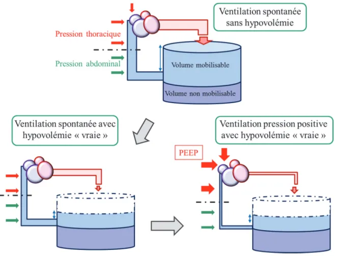 Figure 6.- Conséquences de la ventilation mécanique lors de l’hypovémie « vraie » 