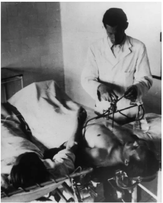 Figure 6  : Transfusion sanguine intra-sternale par utilisation d'une pompe à  roulette en 1949