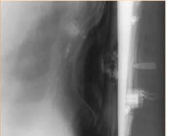 Figure 3 –  Radiographie 