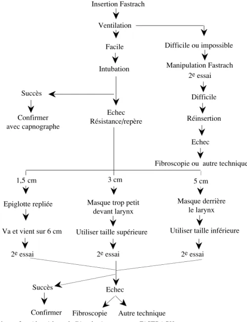 Figure 2 :  Algorithme de l’intubation avec un  FASTRACH