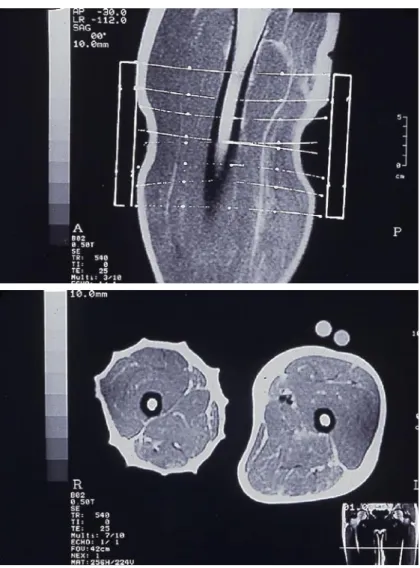 Figure 1 vue longitudinale, Figure 2 vue transversale