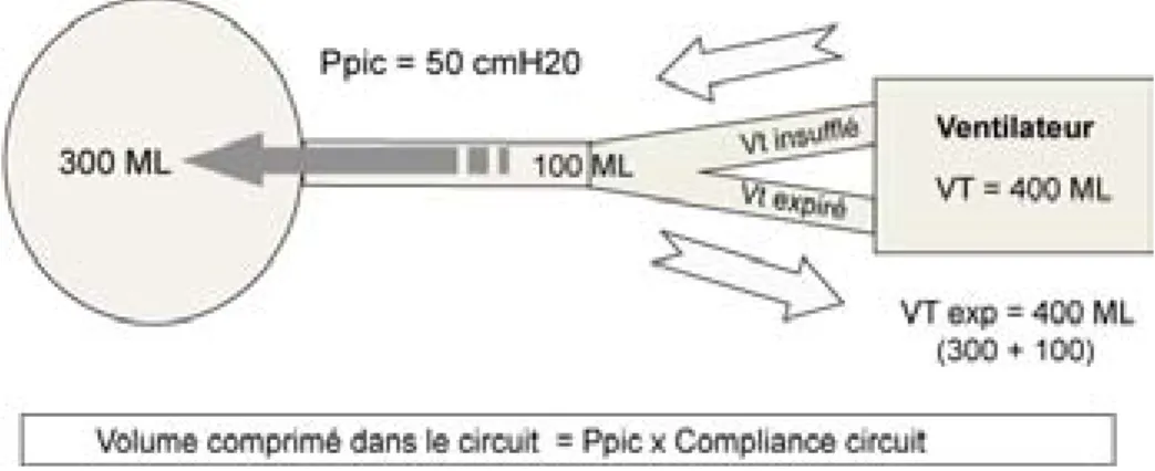 Figure 1 : cette figure illustre le mécanisme de compression des gaz survenant  pendant  la  phase  d’insufflation  qui  est  à  l’origine  de  la  réduction  du  volume  courant  délivré