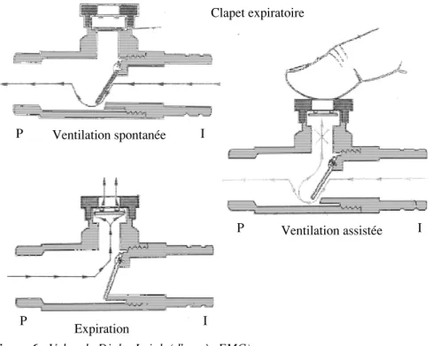 Figure 6 : Valve de Digby-Leigh (d’après EMC)