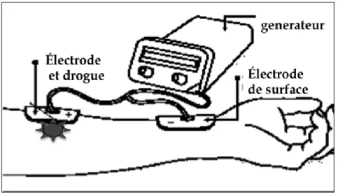 Figure 5.- Description du système d’administration transdermique par iontophorèse. 