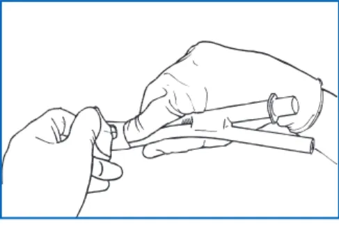 Figure 14 : Maintien du LMA-ProSeal™    avec l’index glissé dans la sangle.