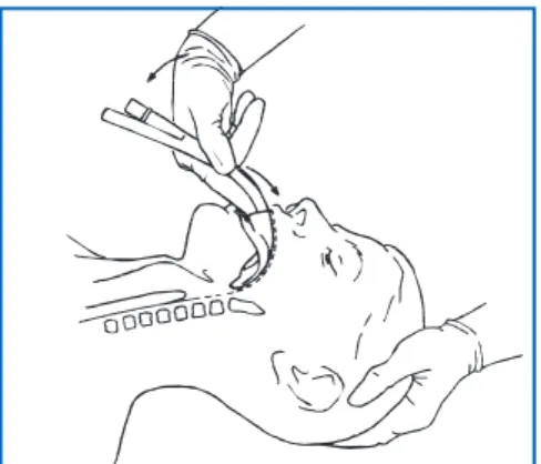 Figure 18 : Avancer l’index vers l’autre main qui exerce une contre-pression.