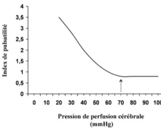 Figure 2.-  Variation de l'index de pulsatilité au Doppler transcrânien en fonction de la pression de perfusion  cérébrale