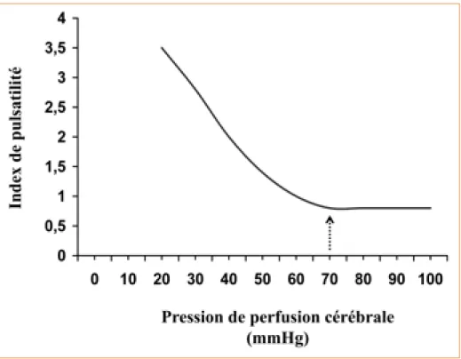 Figure 1 –  Relation entre pression de perfusion cérébrale et index de pulsatilité au  Doppler transcrânien, d’après  (2)