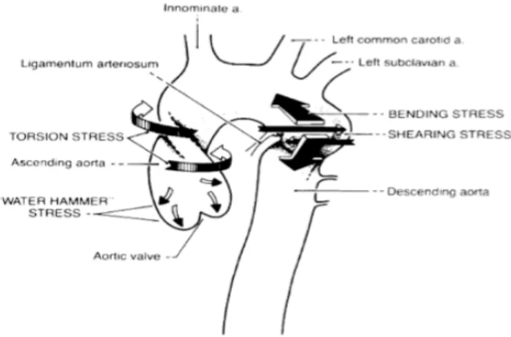 Figure 1. Mécanismes de la lésion traumatique de l’aorte. 