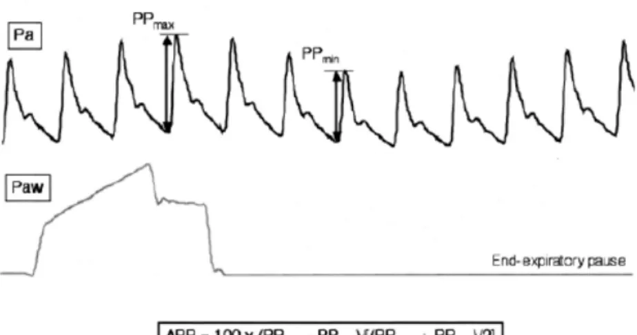 Figure 2. Variations de la pression artérielle 